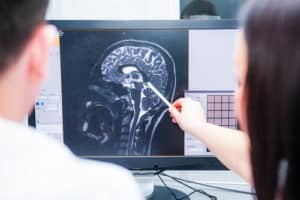 Radiologist explaining brain injury x-ray