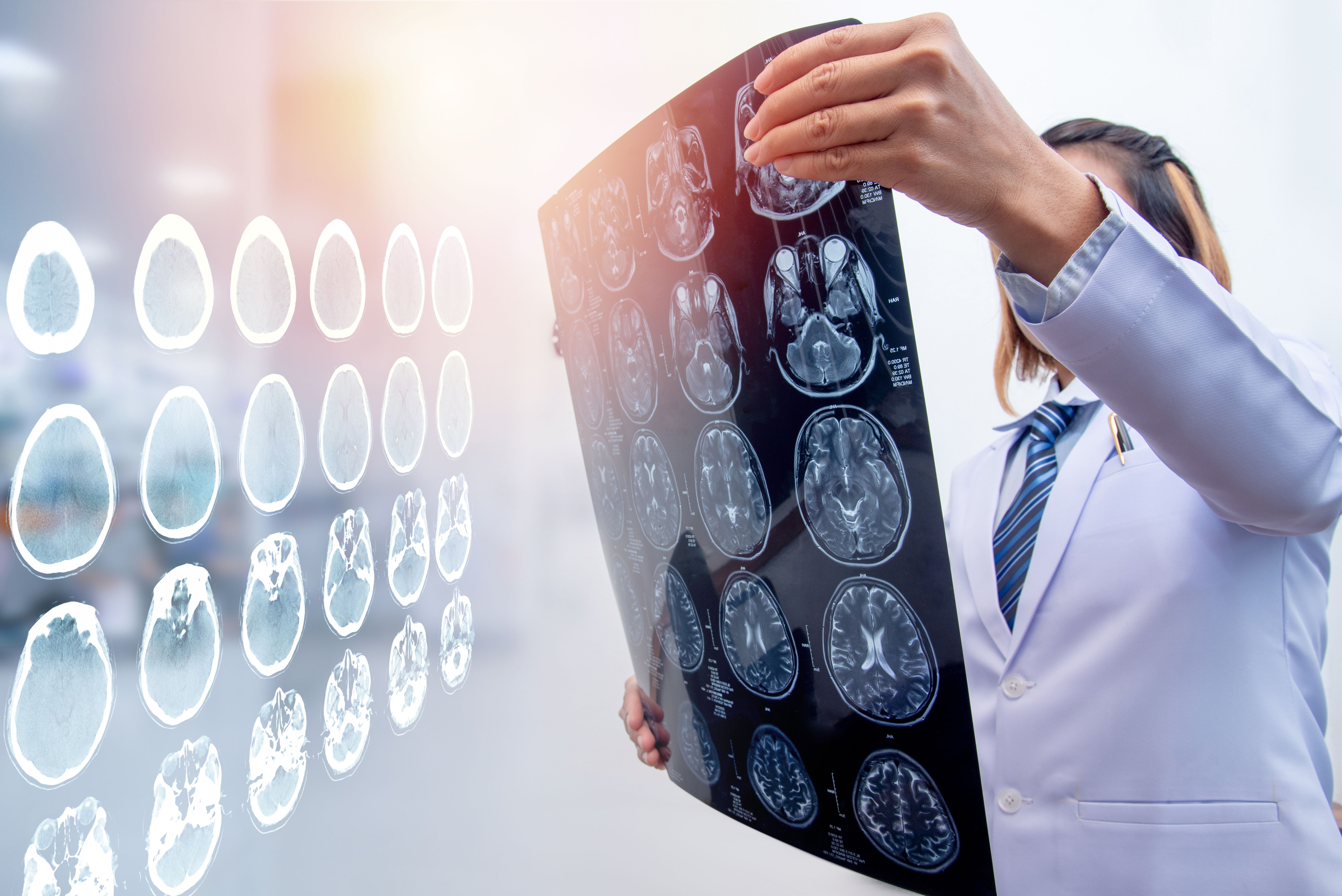 St. Louis Traumatic Brain Injury Lawyer