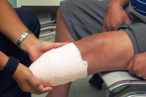 doctor showing leg amputee patient how to care for limb after amputation