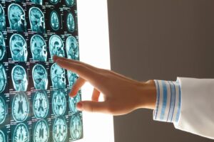 Doctor reviewing a CT scan