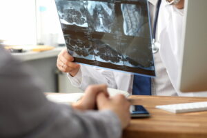 Doctor checking spine x-ray